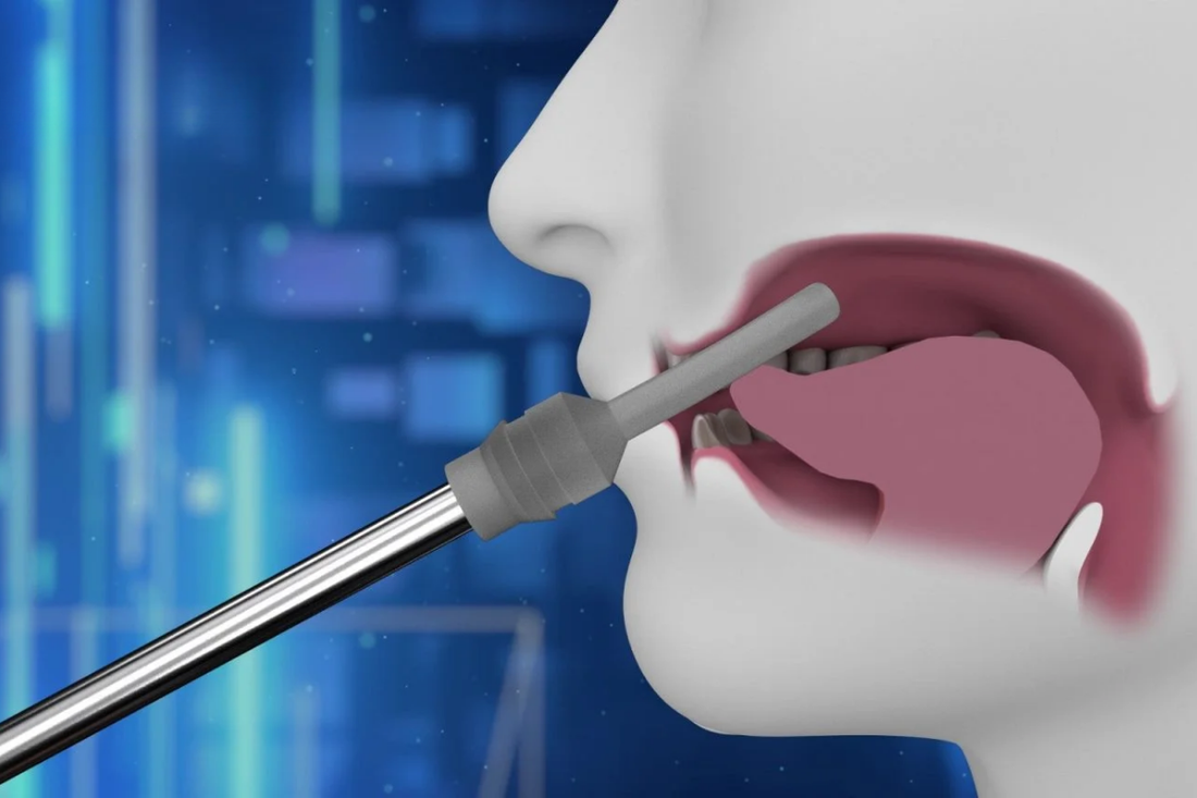 Mayo Clinic Studies REMplenish™ Myo-Nozzle’s Impact on Sleep Apnea