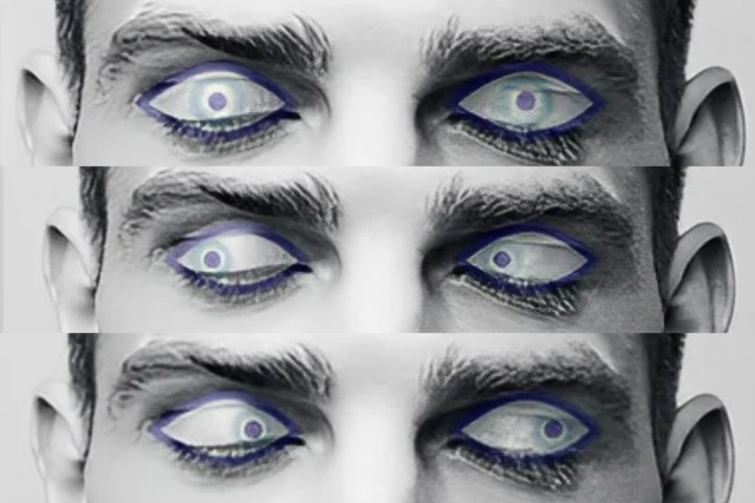 Rapid Eye Movement (REM)