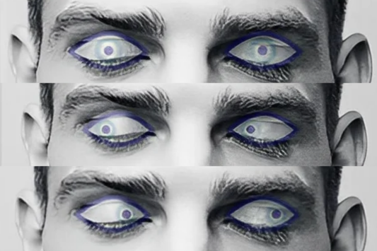 Rapid Eye Movement (REM)